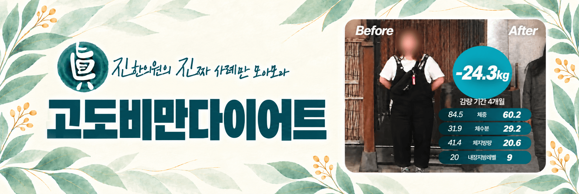 고도비만다이어트 -24.3kg 감량 사례