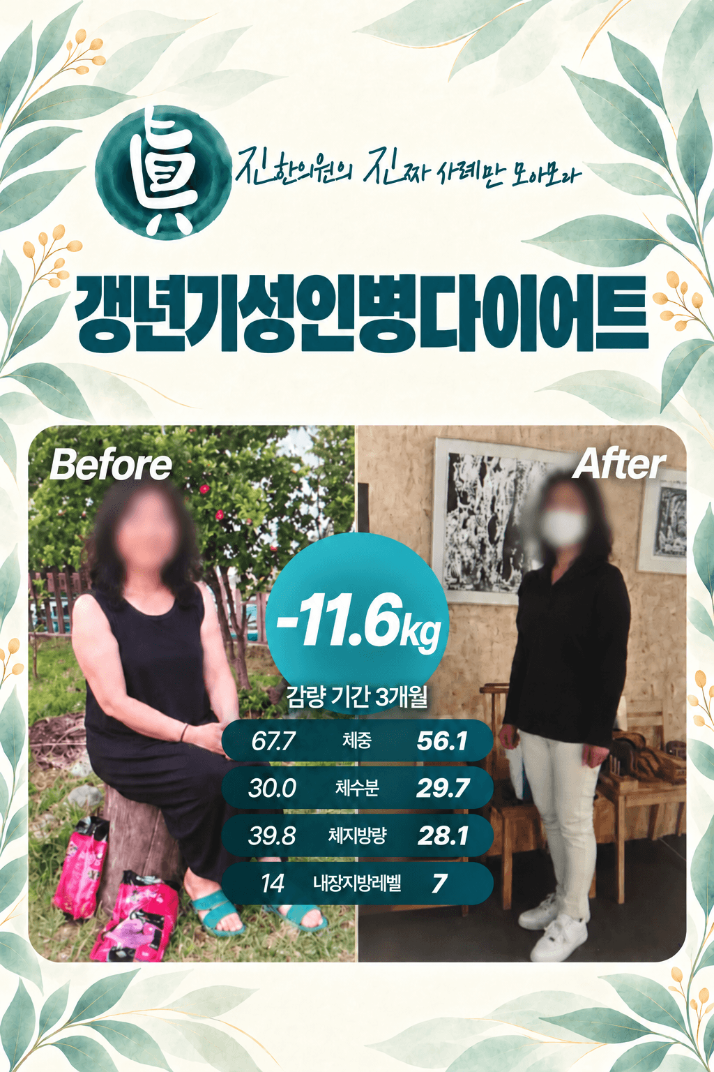 갱년기성인병다이어트 -11.6kg 감량 사례
