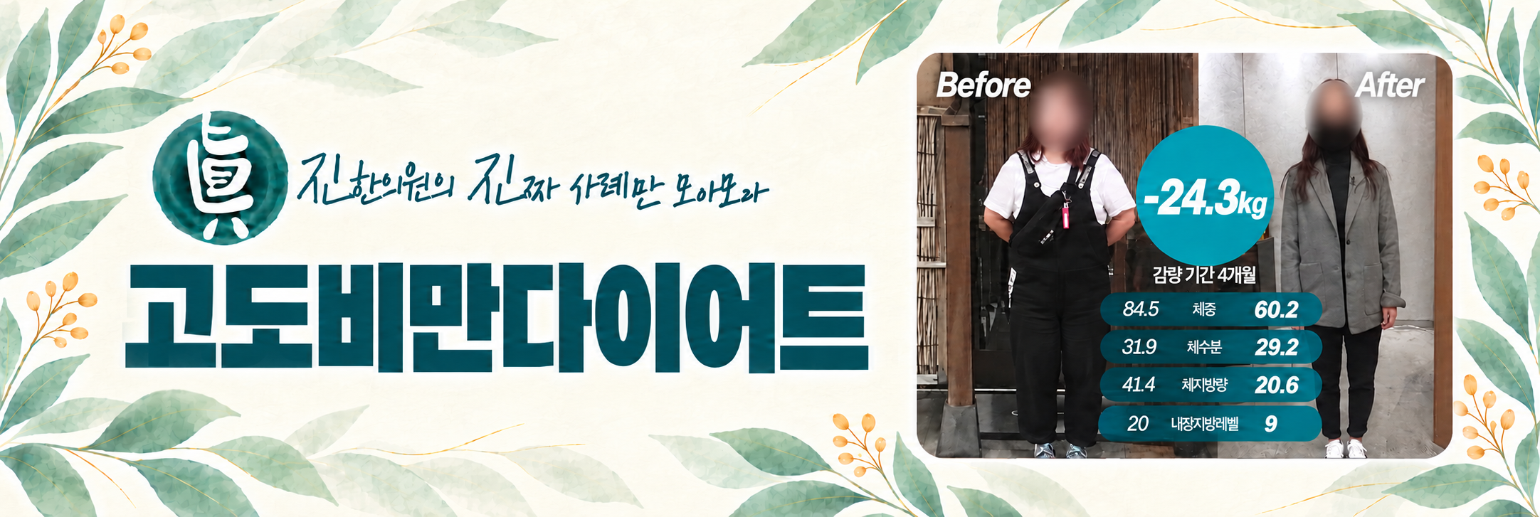 고도비만다이어트 -24.3kg 감량 사례